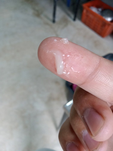 มีมูกใสๆออกช่องคลอด