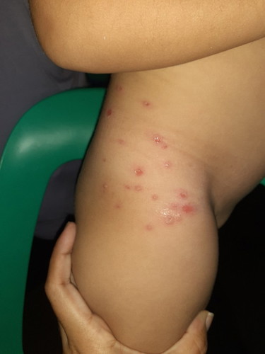 Rashes po kaya ito? O anong klaseng skin problem po kaya?