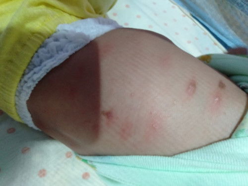 Badan Baby 4 bulan merah2