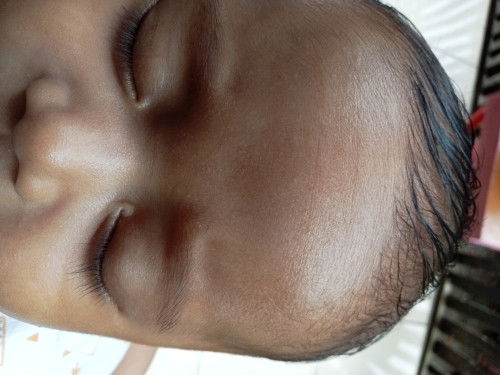 Ujung mata bayi putih