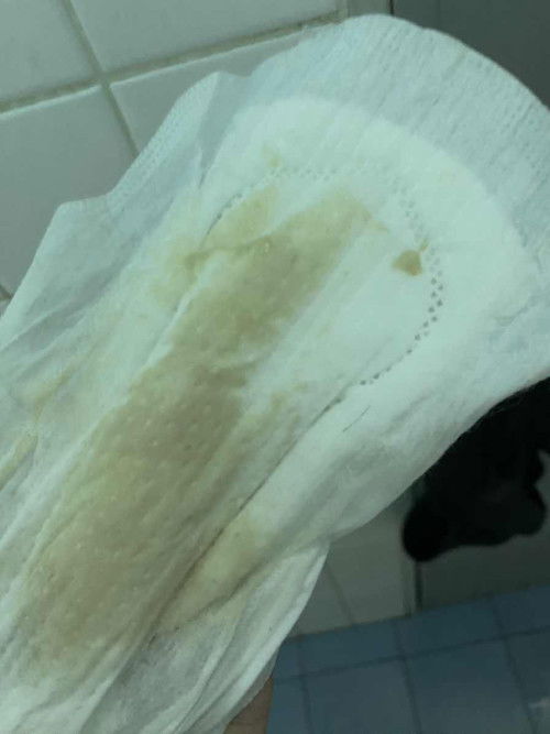 โดนกระตุ้นคลอด