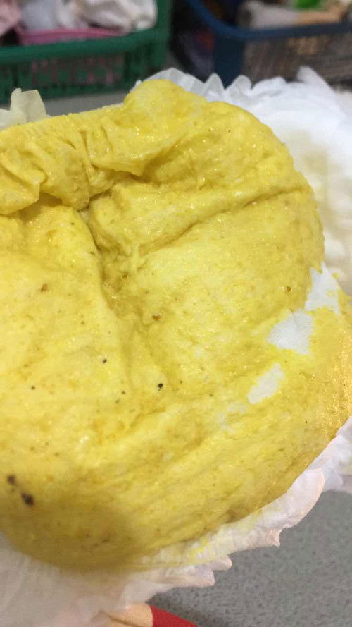 Bayi 9 bulan diare tiba-tiba