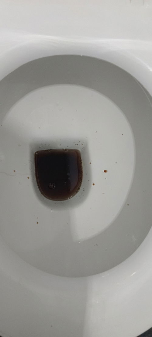 Plasenta previa - plasenta lepas