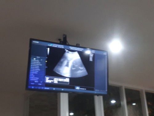 34w bbj 1805.. dulu anak pertama jg bbj 2300 lahir 2800 karena es krim..makanan yg lain apa ya??