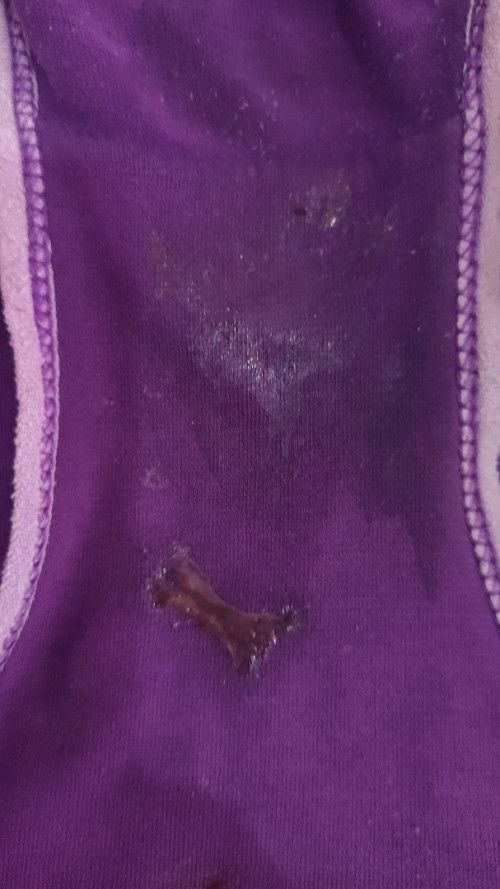 Keluar darah campur lendir