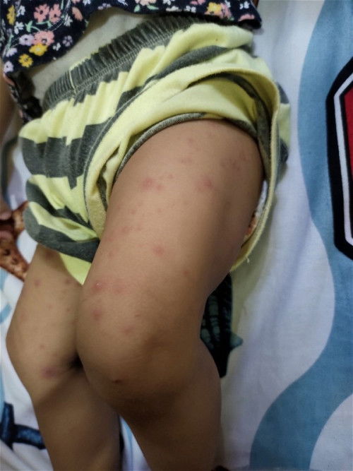 Anaknya ada yang pernah ngalamin gak Bun?