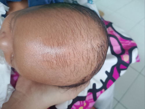 Bayi umur 22 hari anak pertama masih bingung pake skincare atau produk untuk penumbuh rambut