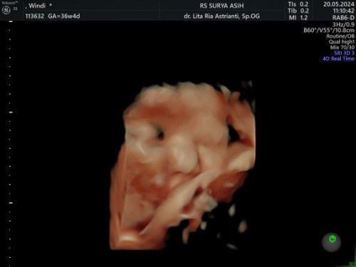 36week sehat sllu kesayangan mmh sampai waktu nya kita jumpa,kita smaa2 berjuang yaa nak..