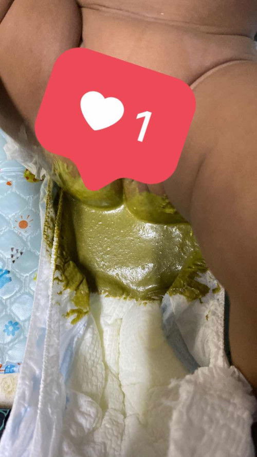 ลูกถ่ายเหลวสีเขียวขี้ม้า