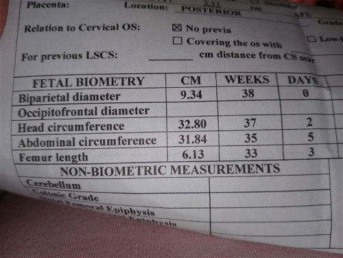 Head circumference ni baby