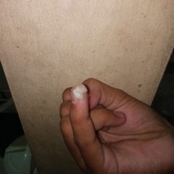 Hallo Bun mohon jawab ,Usia kandungan 37weknd 5hari apakah ini lendir mau melahirkan atau keputihan