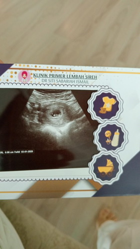 Dah nampak jantung
