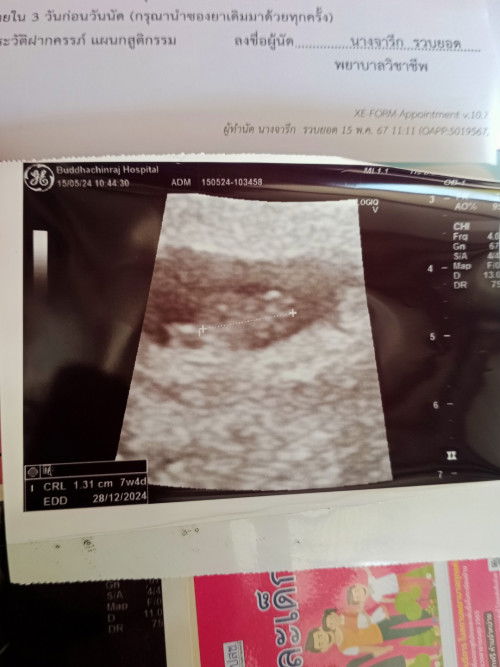 ท้องได้ 7 w 4 d อีกนานไหมค่ะกว่าจะเห็นแขนขาน้อง