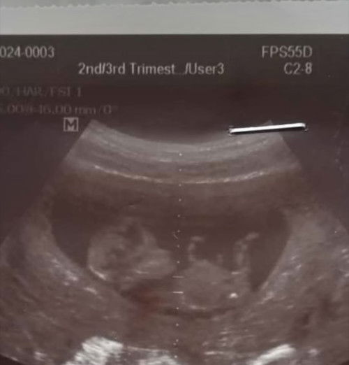 แม่ๆว่าผู้หญิงรึผู้ชายค่ะช่วยดูให้ทีค่ะ