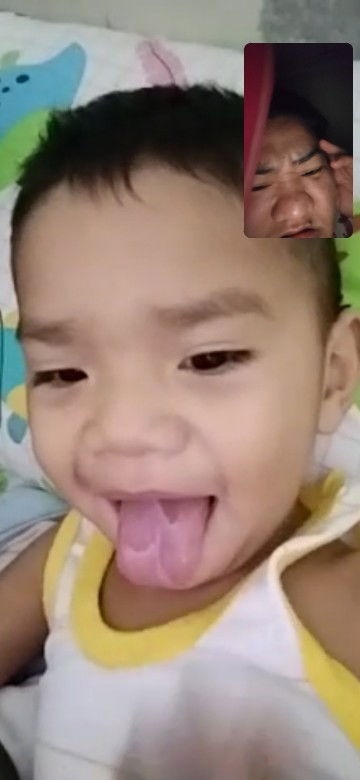 Spot na puti sa dila