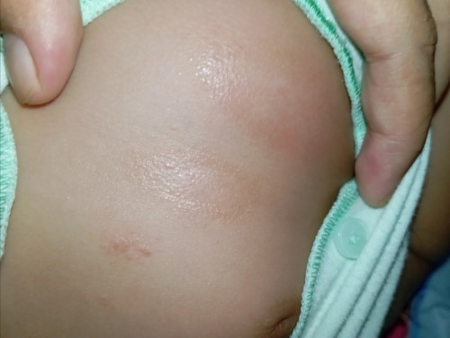 Kulit bayi