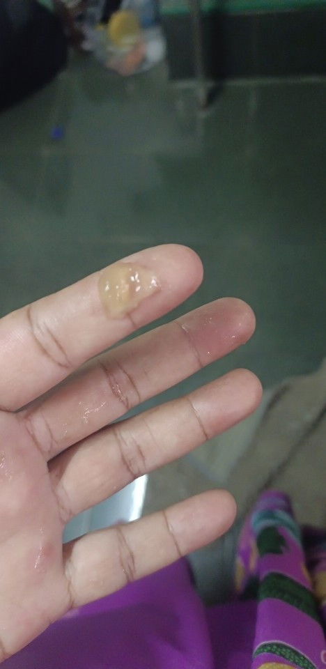 ตั้งครรภ์36W4วัน