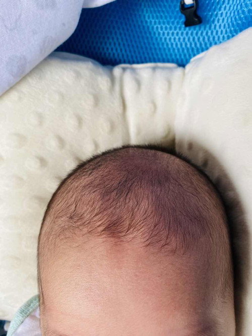 กระหม่อมลูกยุบแบบนี้เกิดจากอะไรคะ แล้วอันตรายมั้ยคะ