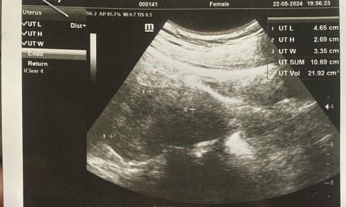 Telat haid tapi tidak hamil