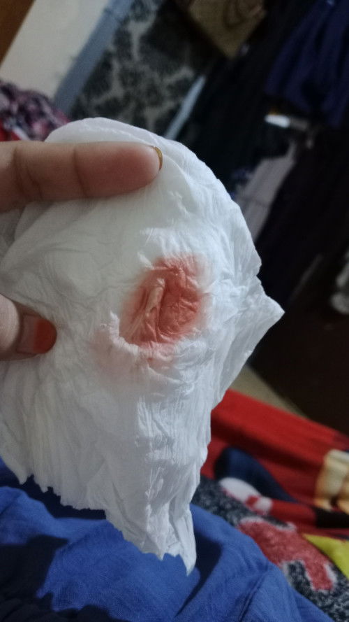 Usia kandungan 12week 4 day