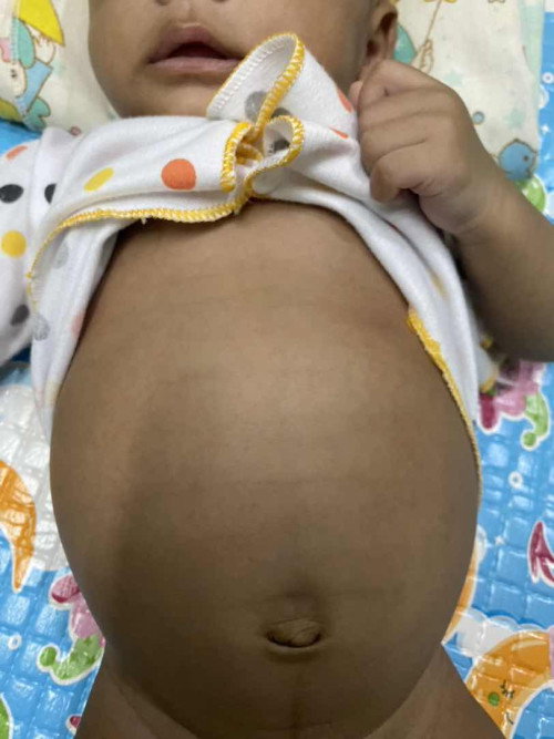 Perut bayi 2 bulan normal seperti apa?