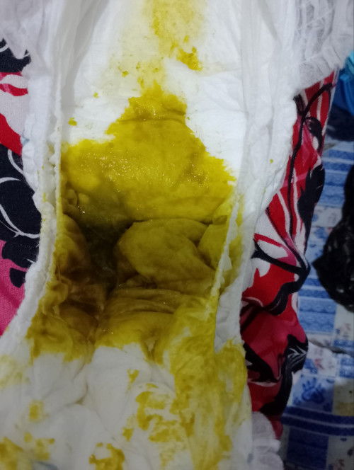 TIBA TIBA PUP SEPERTI JELLY