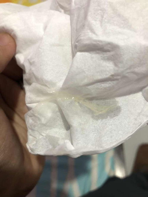 Sharing tentang kb iud