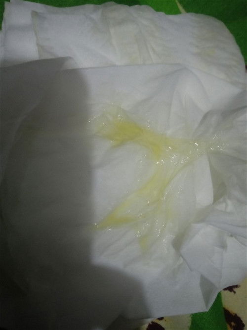 Kehamilan Udah 40minggu