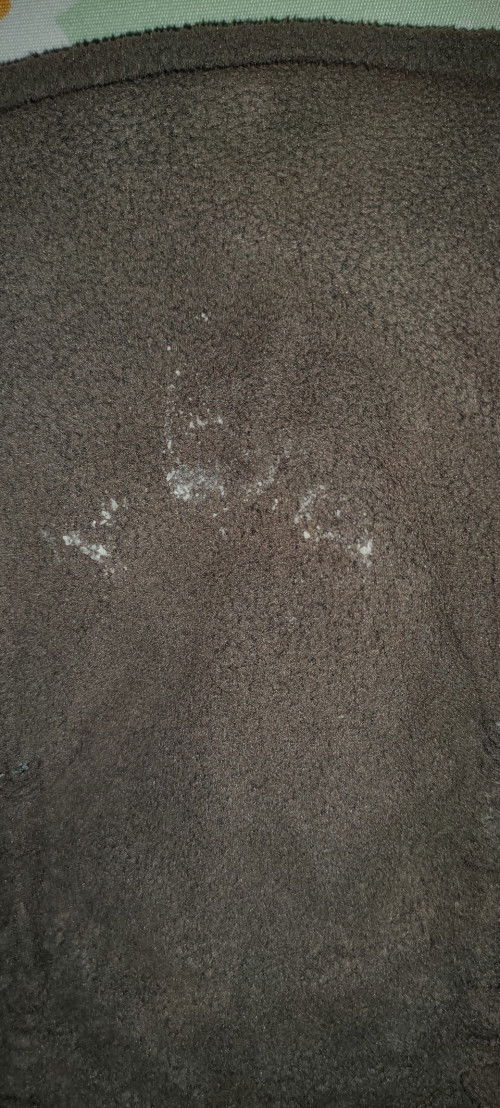 May puti puti sa ihi ni baby.