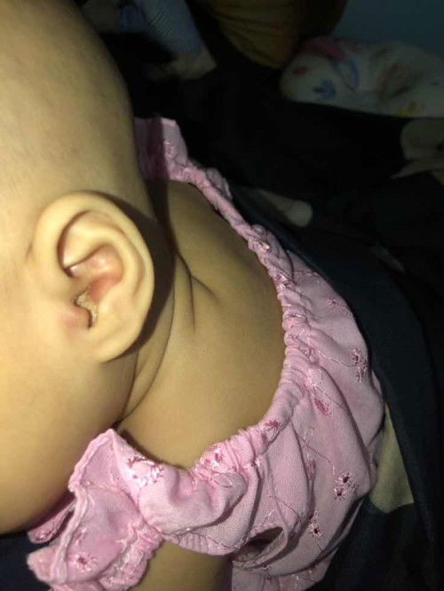 หูน้ำหนวกหรือเปล่าคะแม่ๆ?