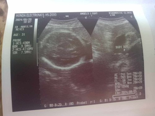 share ko lang mga miii😊
Answered Prayer 😍🥰🎉🥳😇
our panganay🤗