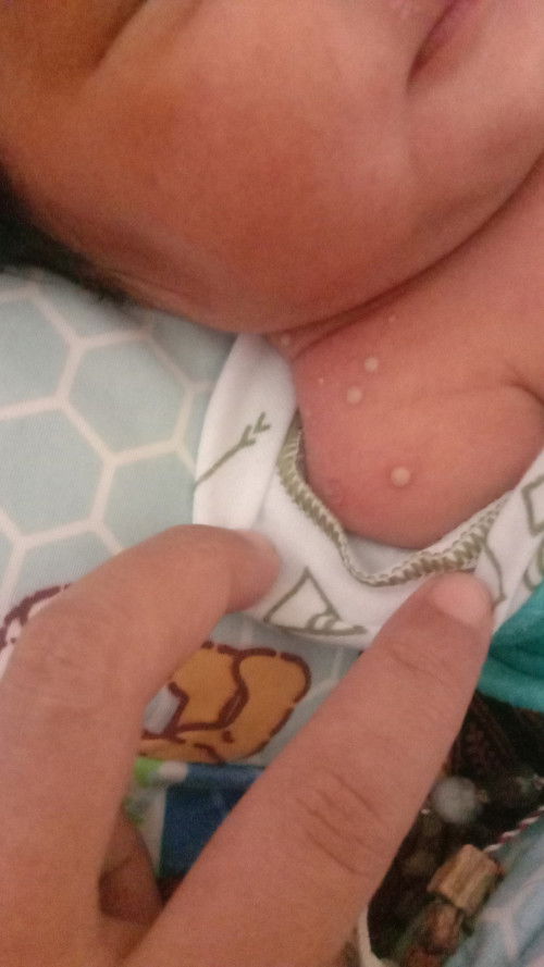 Mau nanya ni bunda2 ada benjol di bayi aku