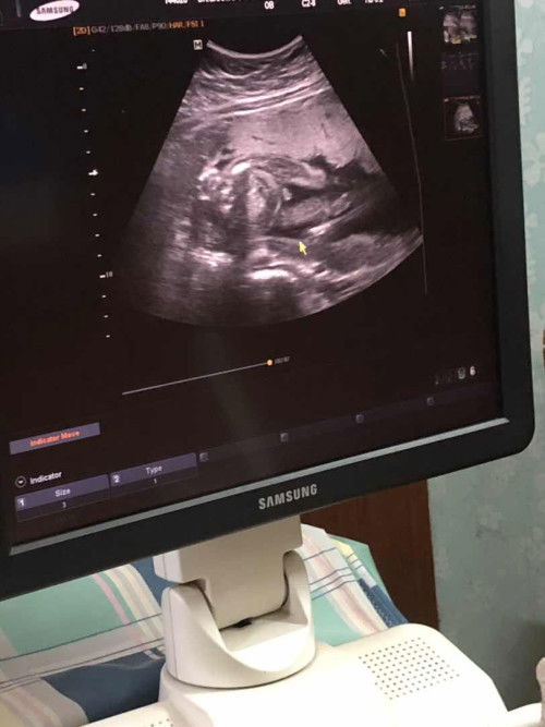 สอบถามเพศลูก