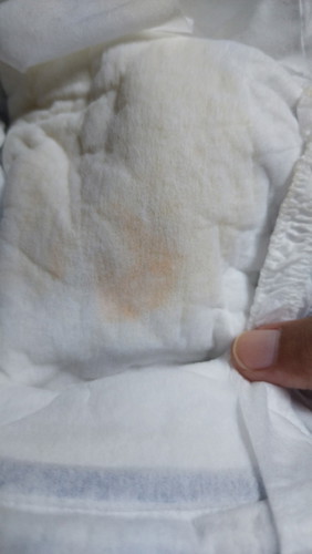 Normal lang po ba sa 4 months yung parang may dugo ang ihi ni baby,?