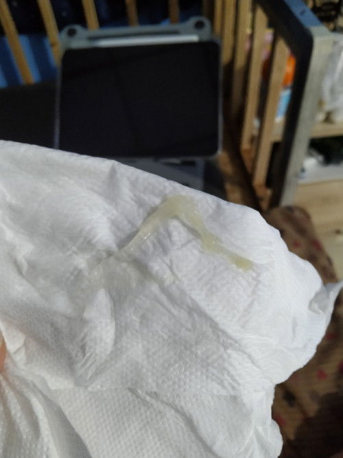 อันนี้ใช่มูกขาวมั้ยคะ 39 วีค 3 วัน
แล้วต้องไปหาหมอมั้ยคะ