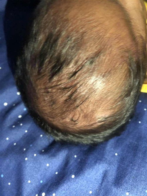 ขอสอบถามหน่อยค่ะเเม่ๆ