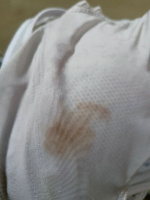 Flek usia kehamilan 7 minggu