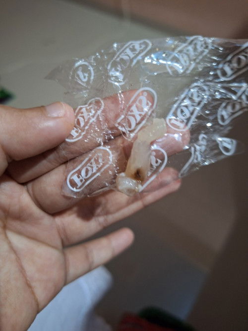 Lendir trimester 3 mendekati HPL