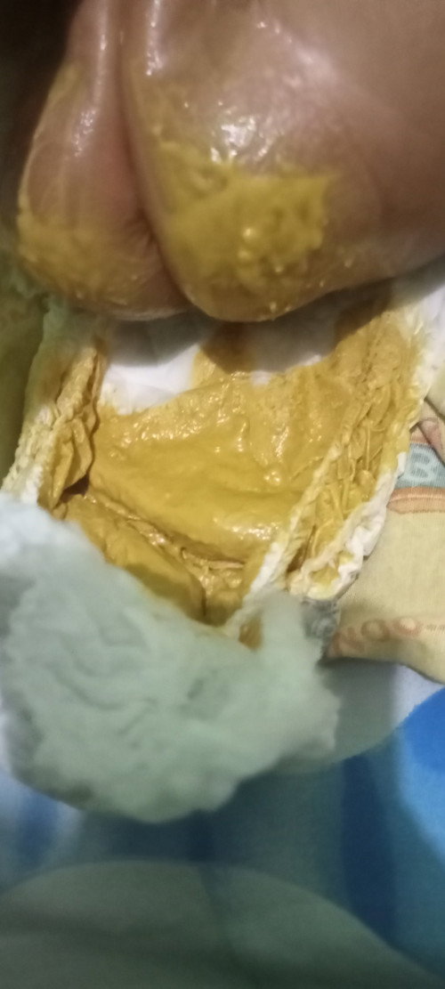pup bayi 2bln stgh