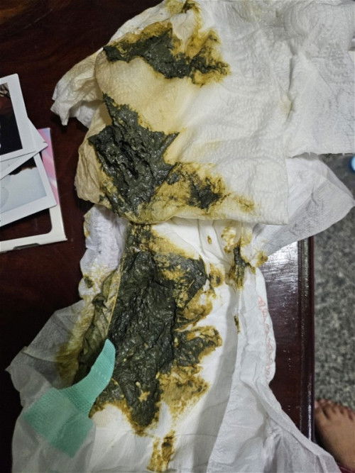 ลูกไม่ถ่ายมา 3-4 วัน ไปหาหมอมาแล้ว