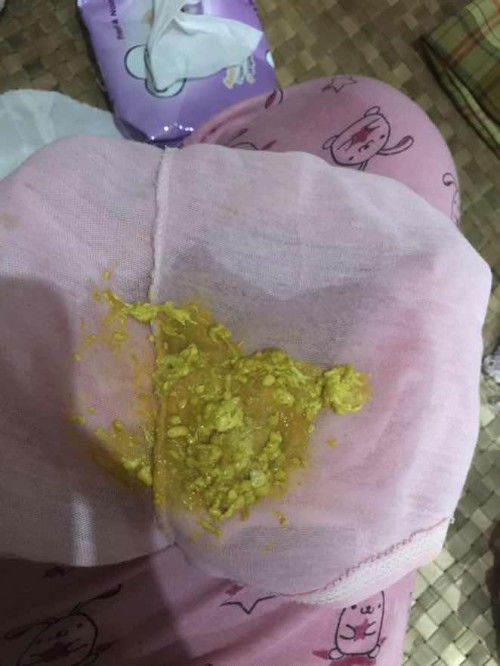 Pup bayi bergerinjil sampe 5x sehari