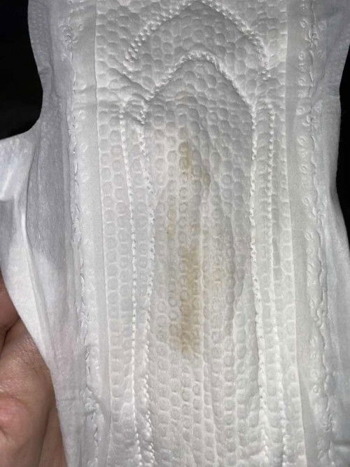 keputihan atau apa ya