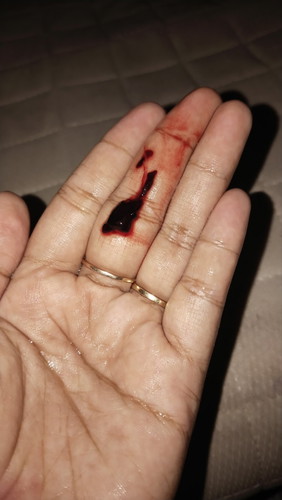 Hamil 3 bulan lebih, keluar gumpalan darah, paginya keluar darah kyk haid. Info dlu bunda² 😌🙏