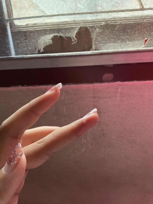 มีแม่ๆคนไหนเคยเป็นไหมคะ