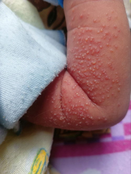 Barangkali ada yang sama