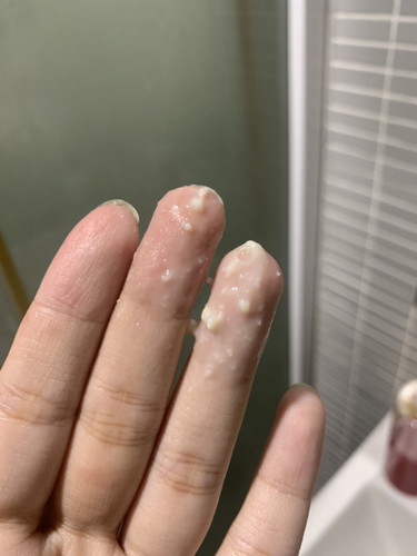 ตกขาวไหลออกมาแบบนี้ผิดปกติหรือเปล่าคะ ไม่มีกลิ่นและไม่คันค่ะ