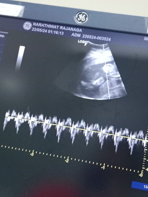 ลูกดิ้นน้อย