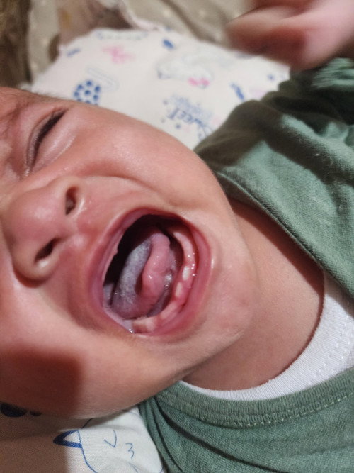 Bayi Tumbuh gigi