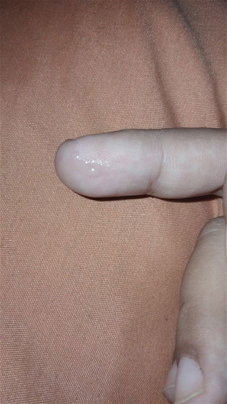 Tanda persalinan atau bukan?