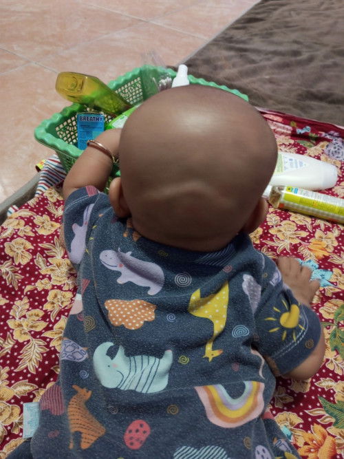 Kepala bayi